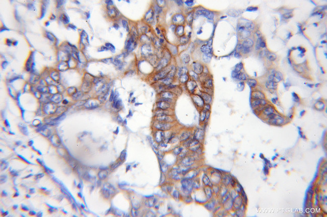 ASCC2 Antibody in Immunohistochemistry (Paraffin) (IHC (P))