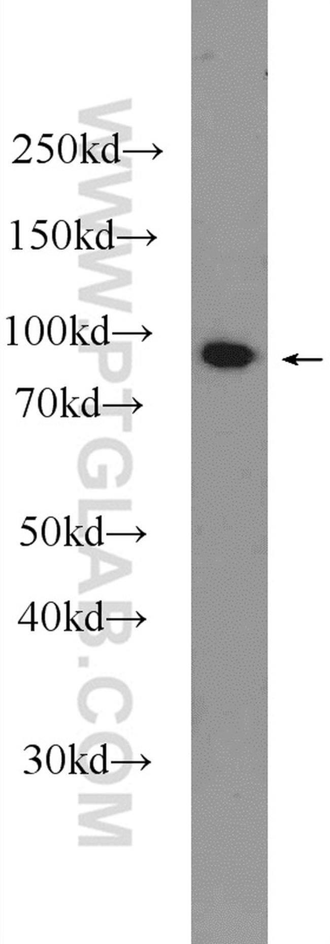 ASCC2 Antibody in Western Blot (WB)