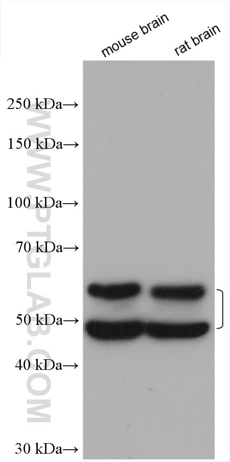 CaMKII beta Antibody in Western Blot (WB)