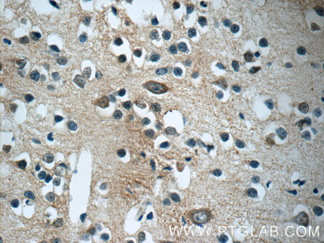 CaMKII beta Antibody in Immunohistochemistry (Paraffin) (IHC (P))