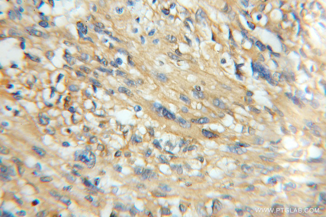 CaMKII beta Antibody in Immunohistochemistry (Paraffin) (IHC (P))