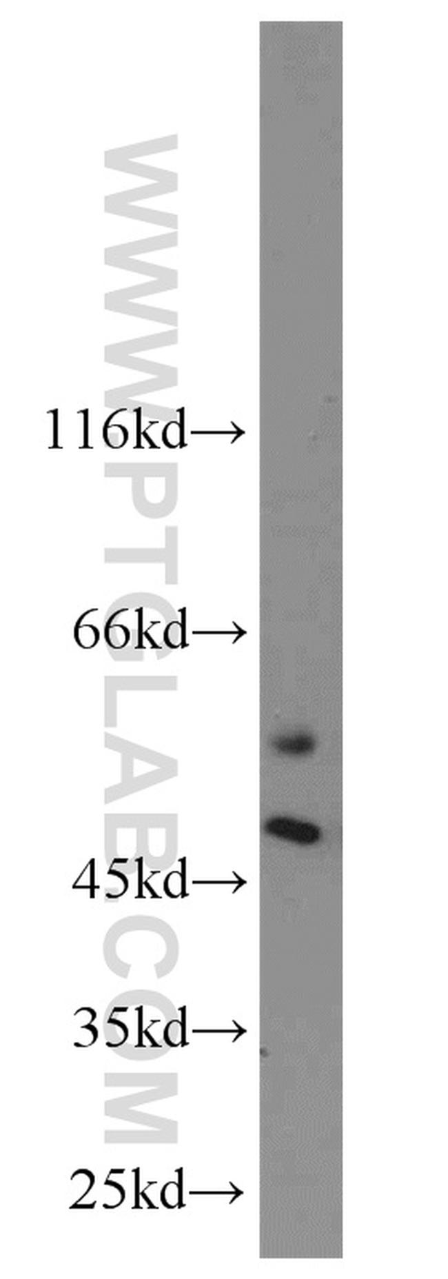 CaMKII beta Antibody in Western Blot (WB)