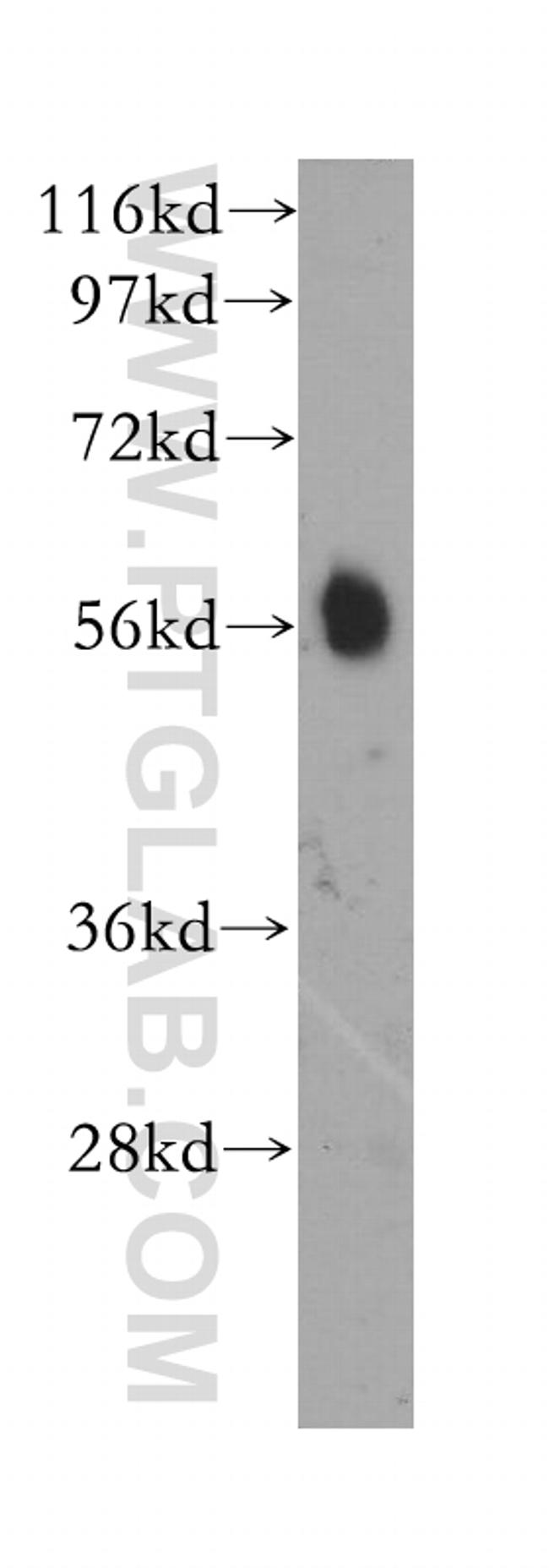 CaMKII beta Antibody in Western Blot (WB)