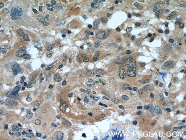 MAGED1 Antibody in Immunohistochemistry (Paraffin) (IHC (P))