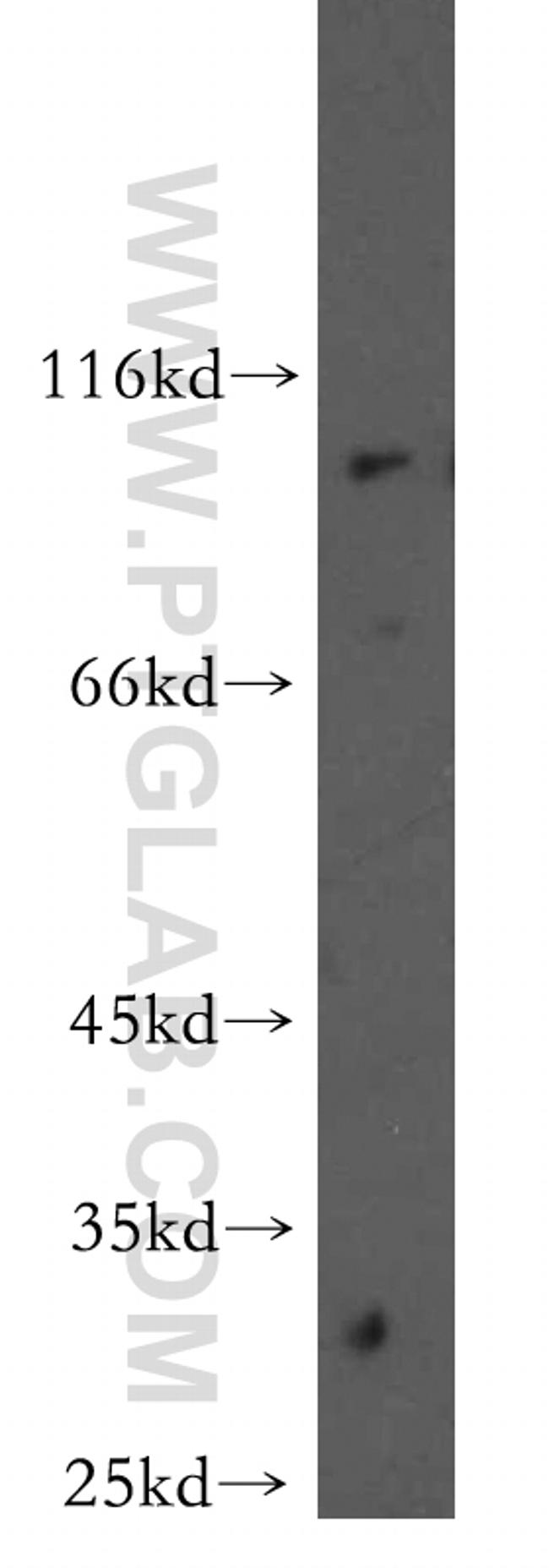 MAGED1 Antibody in Western Blot (WB)