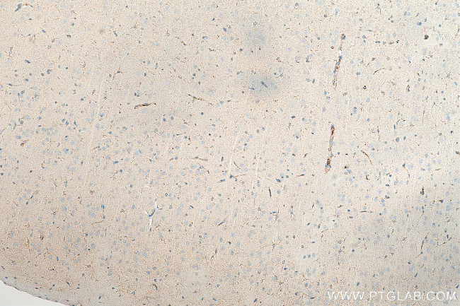 MOXD1 Antibody in Immunohistochemistry (Paraffin) (IHC (P))