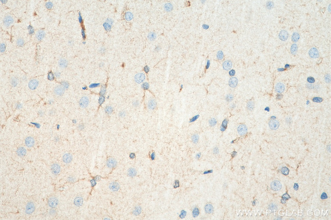 MOXD1 Antibody in Immunohistochemistry (Paraffin) (IHC (P))