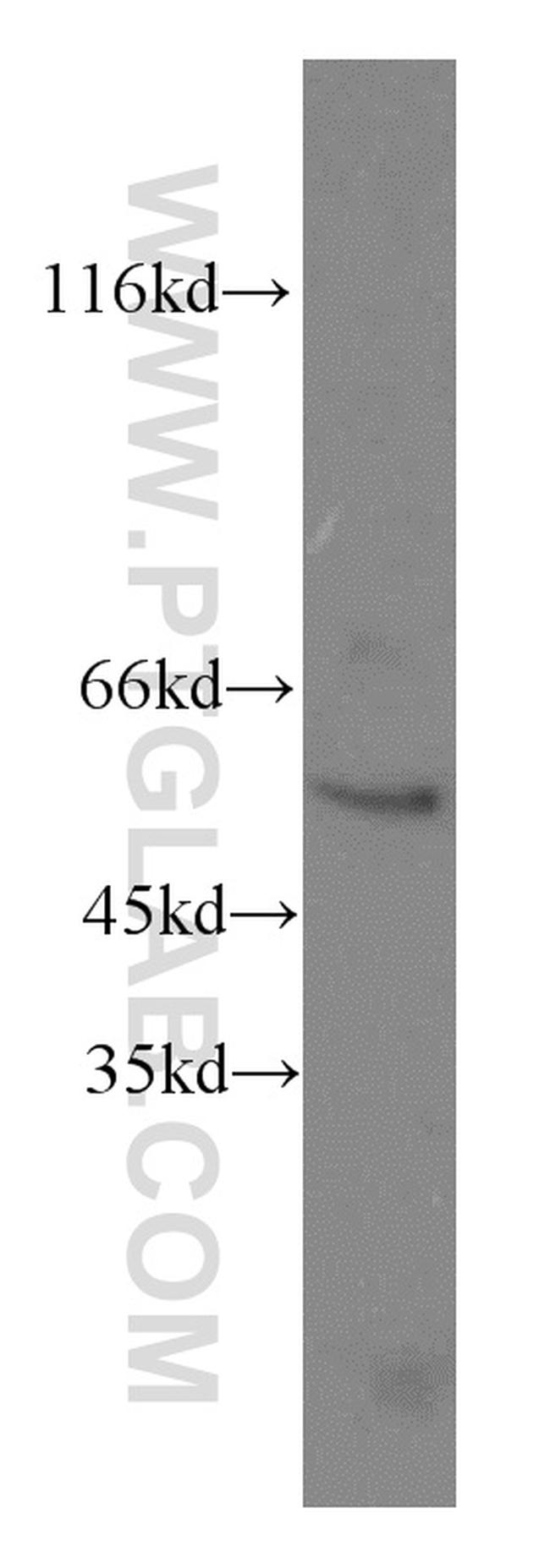 MOXD1 Antibody in Western Blot (WB)