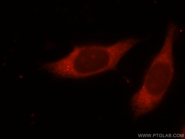 NMT1 Antibody in Immunocytochemistry (ICC/IF)