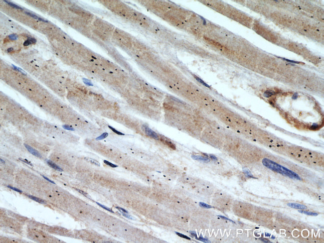 NMT1 Antibody in Immunohistochemistry (Paraffin) (IHC (P))