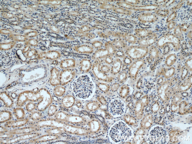 NMT1 Antibody in Immunohistochemistry (Paraffin) (IHC (P))