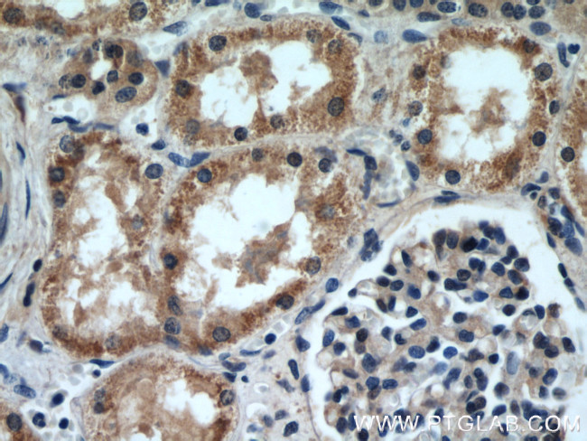 NMT1 Antibody in Immunohistochemistry (Paraffin) (IHC (P))