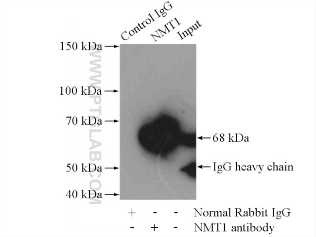 NMT1 Antibody in Immunoprecipitation (IP)