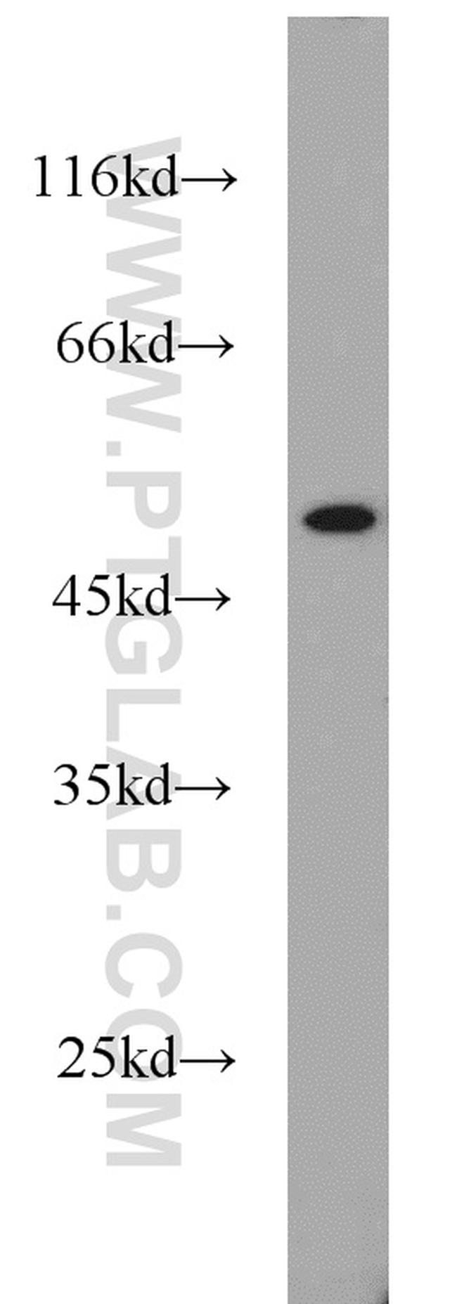 NMT1 Antibody in Western Blot (WB)