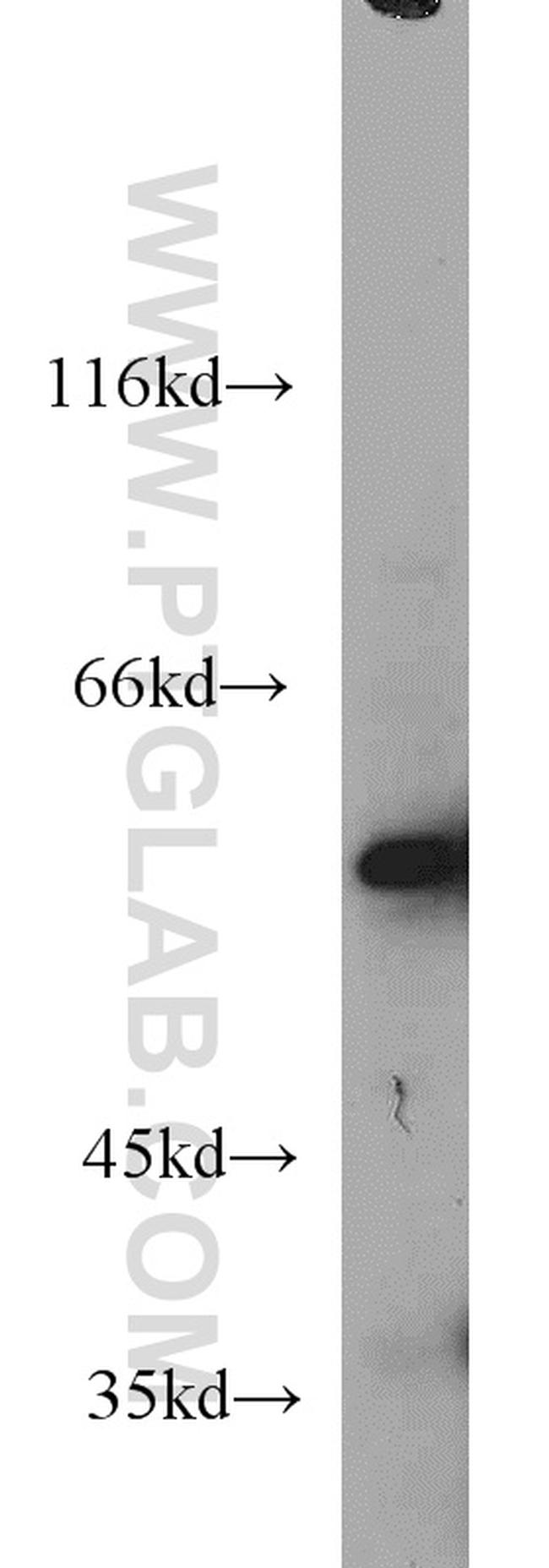 NMT1 Antibody in Western Blot (WB)