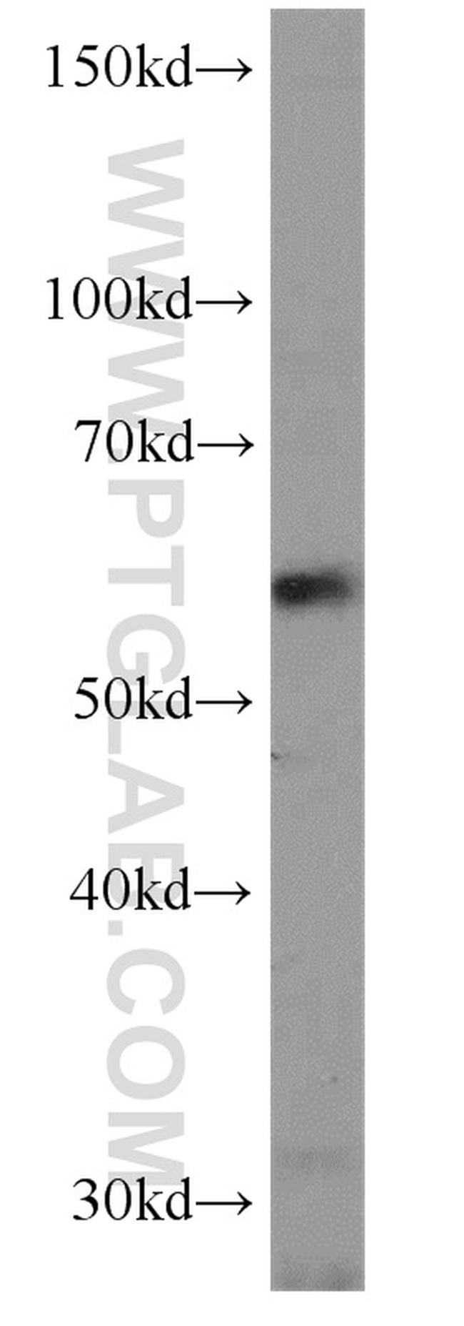 NMT1 Antibody in Western Blot (WB)