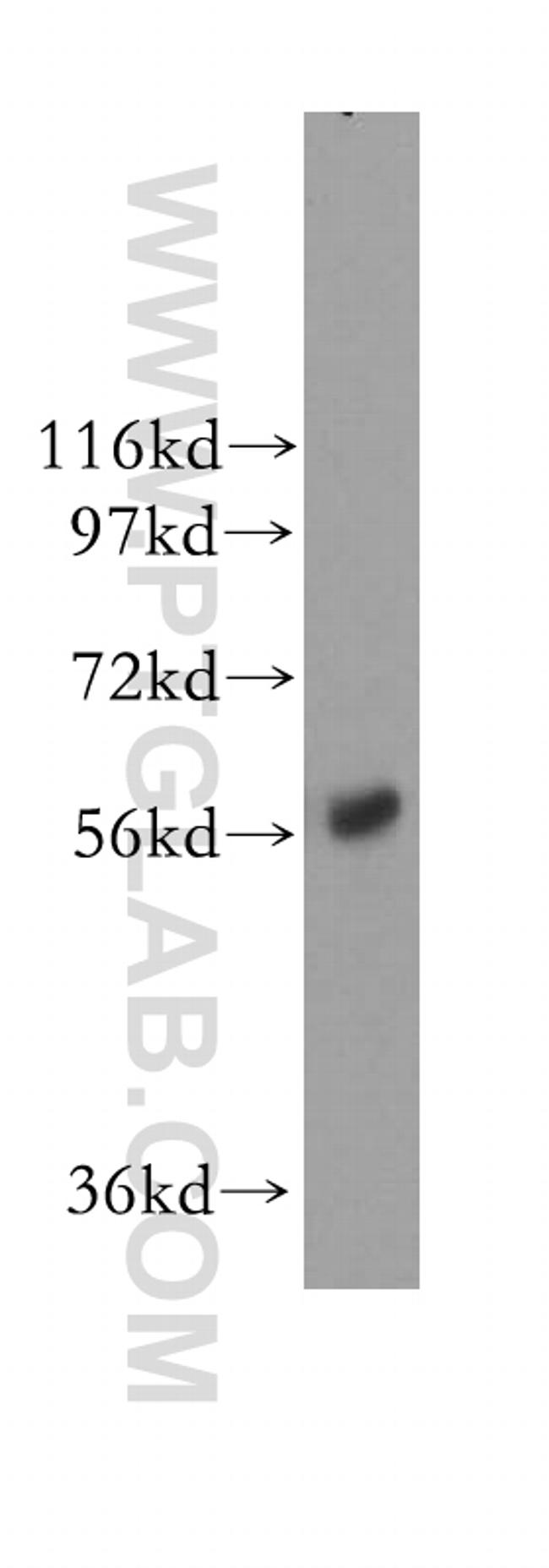 NMT1 Antibody in Western Blot (WB)