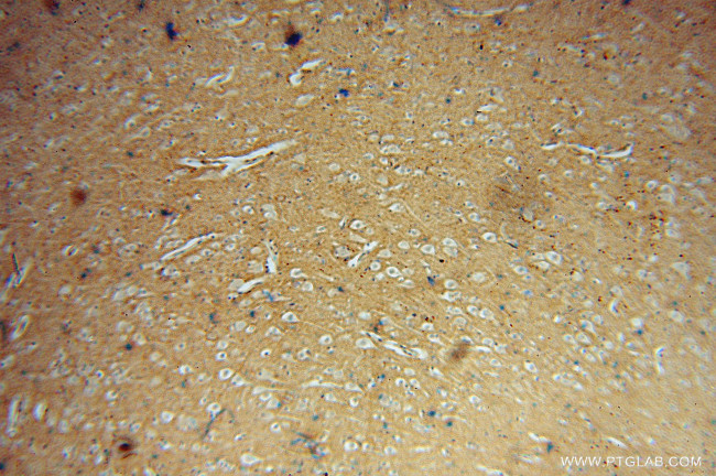 DGKA Antibody in Immunohistochemistry (Paraffin) (IHC (P))