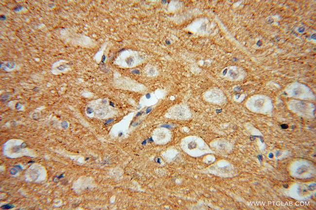 DGKA Antibody in Immunohistochemistry (Paraffin) (IHC (P))