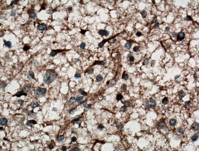 DGKA Antibody in Immunohistochemistry (Paraffin) (IHC (P))