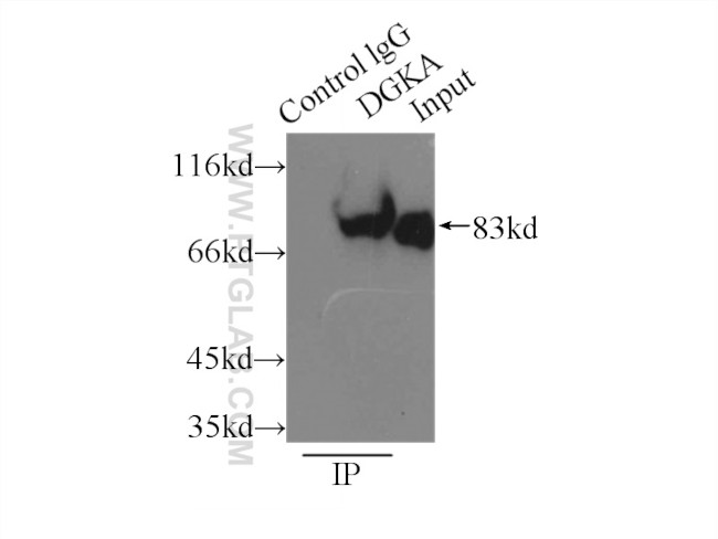 DGKA Antibody in Immunoprecipitation (IP)