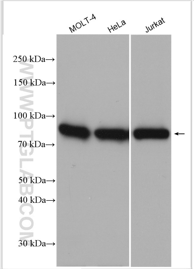 DGKA Antibody in Western Blot (WB)