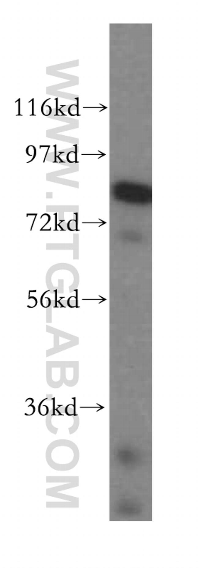 DGKA Antibody in Western Blot (WB)