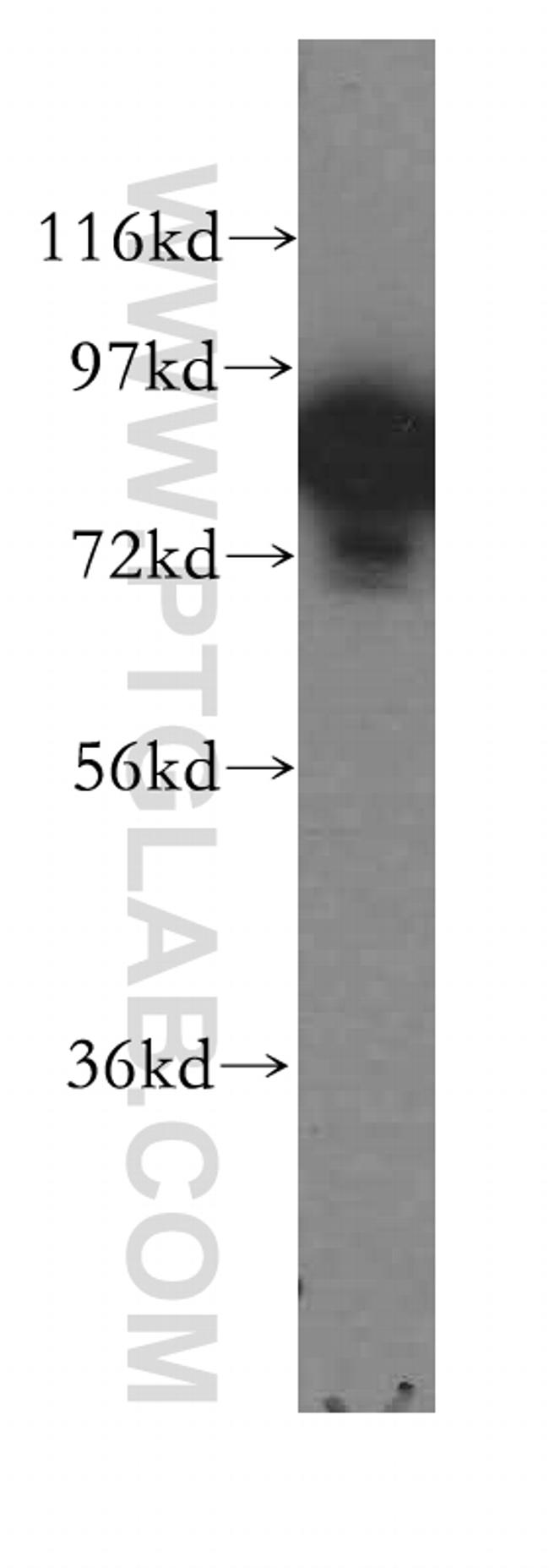 DGKA Antibody in Western Blot (WB)