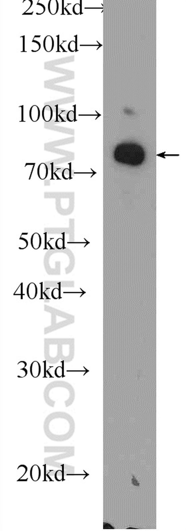 DGKA Antibody in Western Blot (WB)