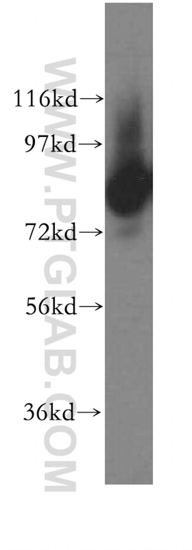 DGKA Antibody in Western Blot (WB)