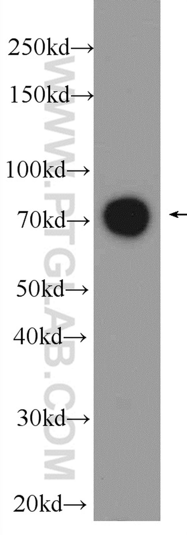 DGKA Antibody in Western Blot (WB)