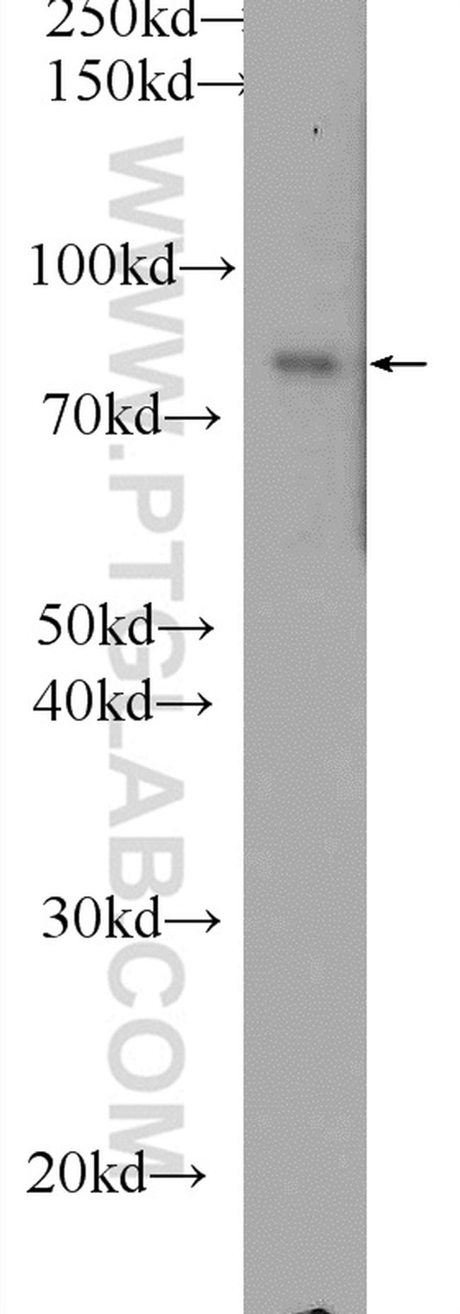 DGKA Antibody in Western Blot (WB)