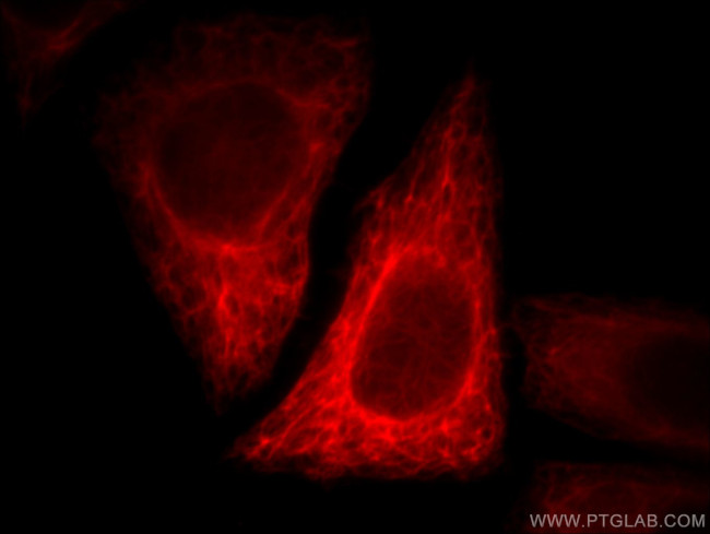 Antizyme inhibitor 1 Antibody in Immunocytochemistry (ICC/IF)