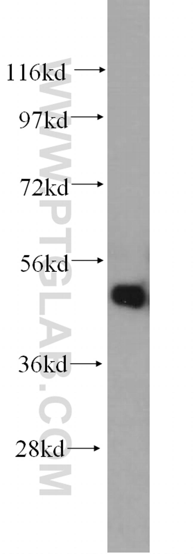 Antizyme inhibitor 1 Antibody in Western Blot (WB)