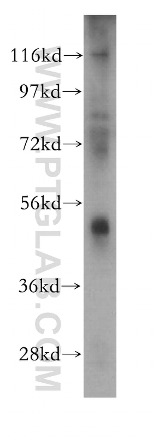 Antizyme inhibitor 1 Antibody in Western Blot (WB)