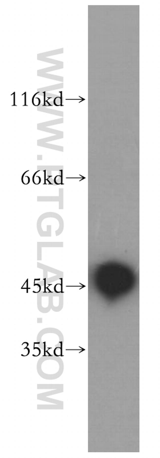 Antizyme inhibitor 1 Antibody in Western Blot (WB)