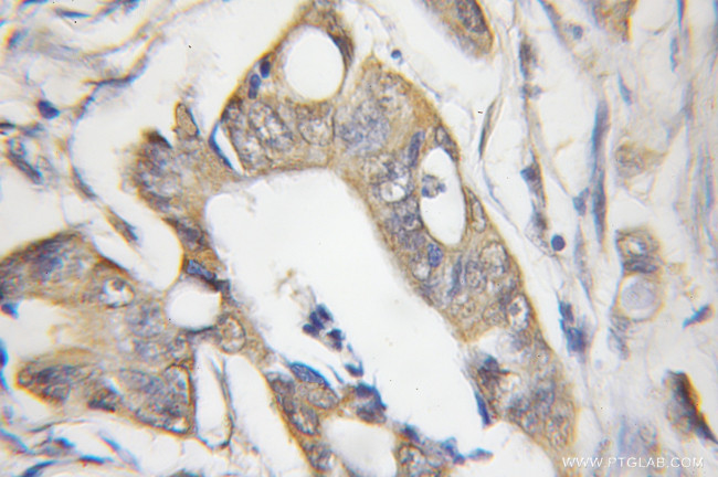 CHRNB1 Antibody in Immunohistochemistry (Paraffin) (IHC (P))