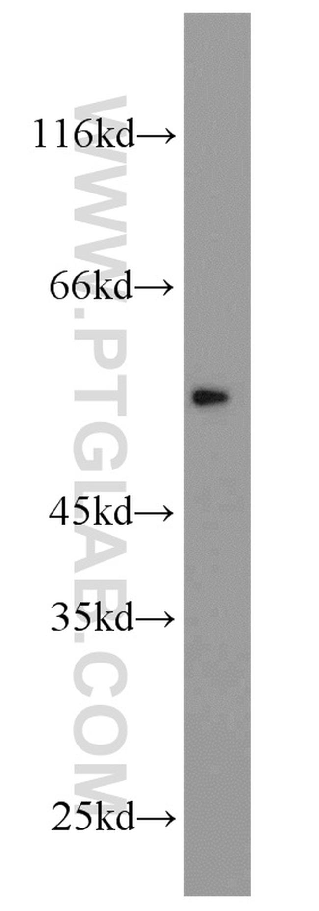 CHRNB1 Antibody in Western Blot (WB)