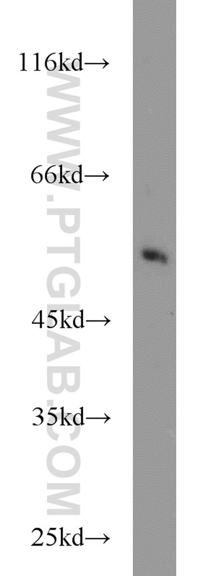 CHRNB1 Antibody in Western Blot (WB)