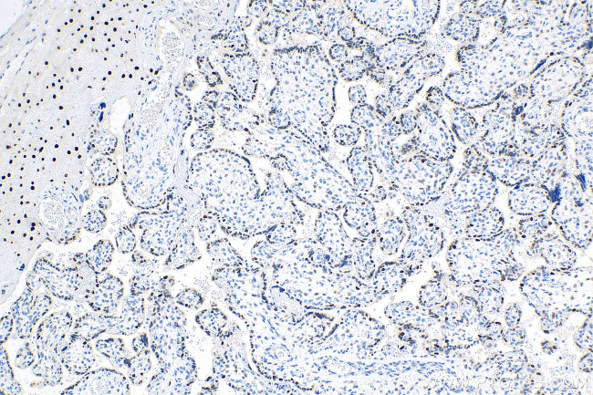 Cyclin E1 Antibody in Immunohistochemistry (Paraffin) (IHC (P))