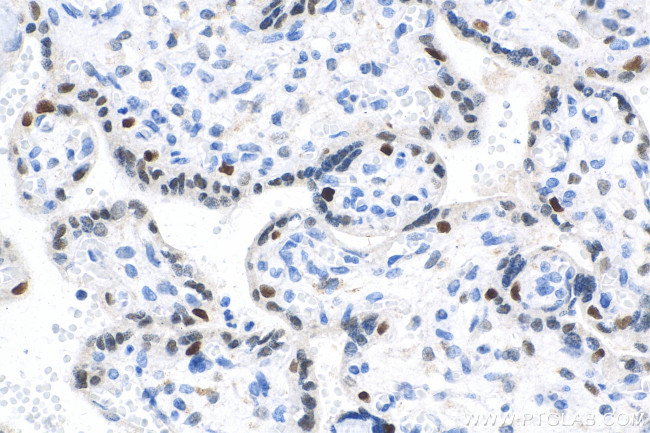 Cyclin E1 Antibody in Immunohistochemistry (Paraffin) (IHC (P))