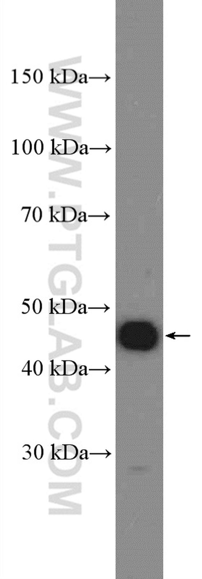 Cyclin E1 Antibody in Western Blot (WB)