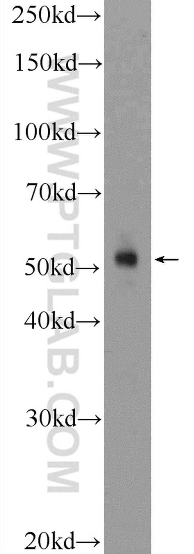 Cyclin E1 Antibody in Western Blot (WB)