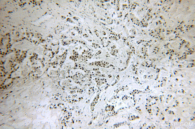 PYGO2 Antibody in Immunohistochemistry (Paraffin) (IHC (P))