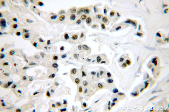 PYGO2 Antibody in Immunohistochemistry (Paraffin) (IHC (P))