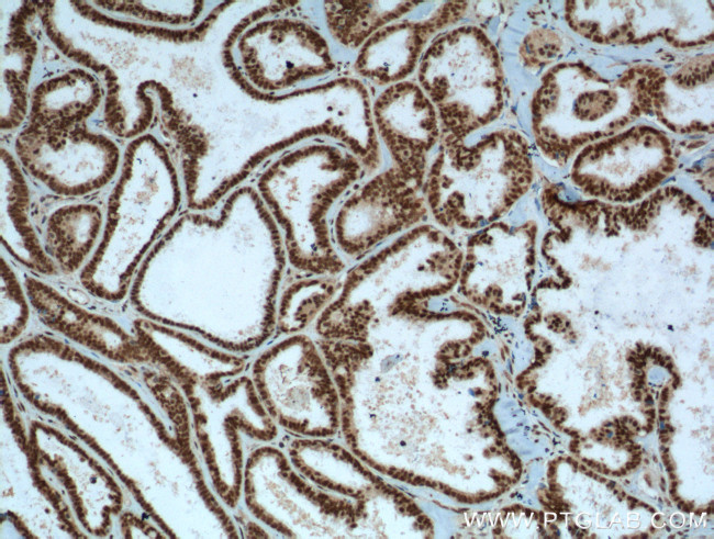 PYGO2 Antibody in Immunohistochemistry (Paraffin) (IHC (P))