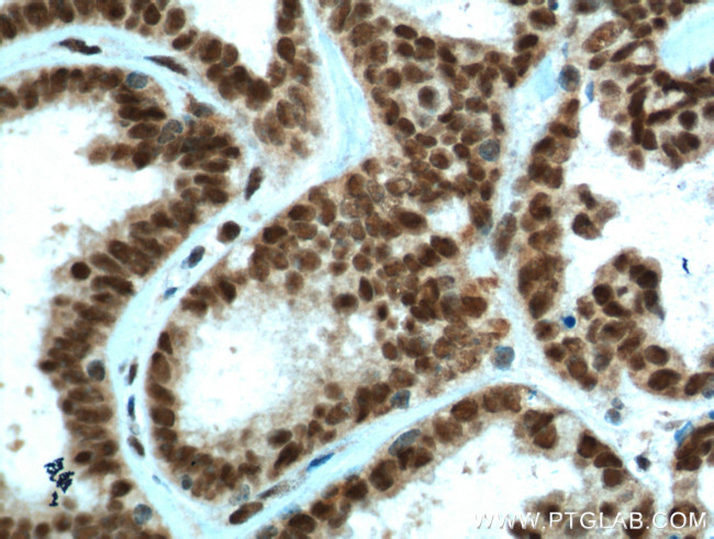 PYGO2 Antibody in Immunohistochemistry (Paraffin) (IHC (P))