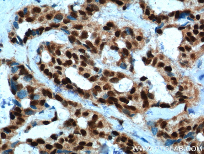 PYGO2 Antibody in Immunohistochemistry (Paraffin) (IHC (P))