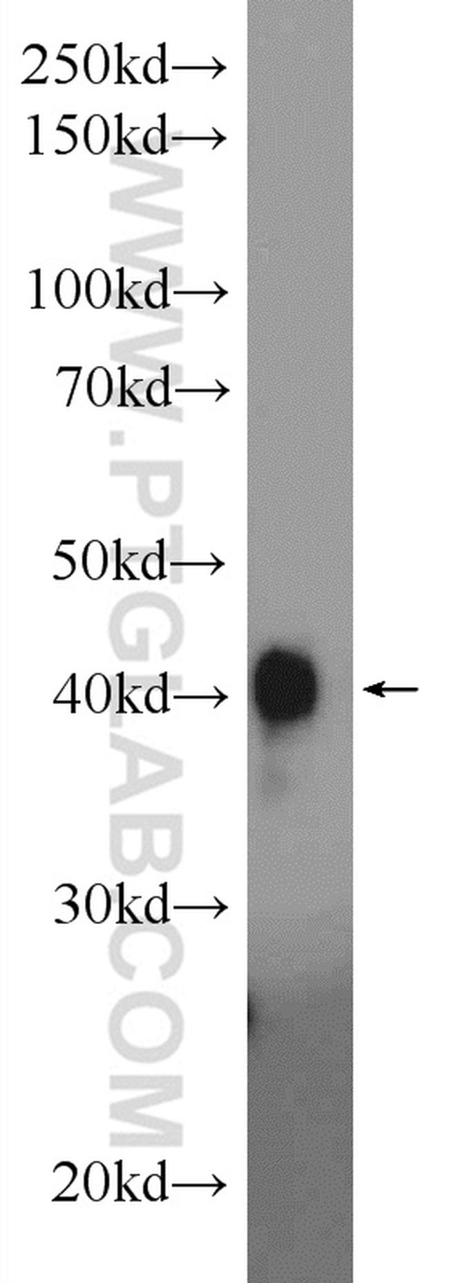 PYGO2 Antibody in Western Blot (WB)