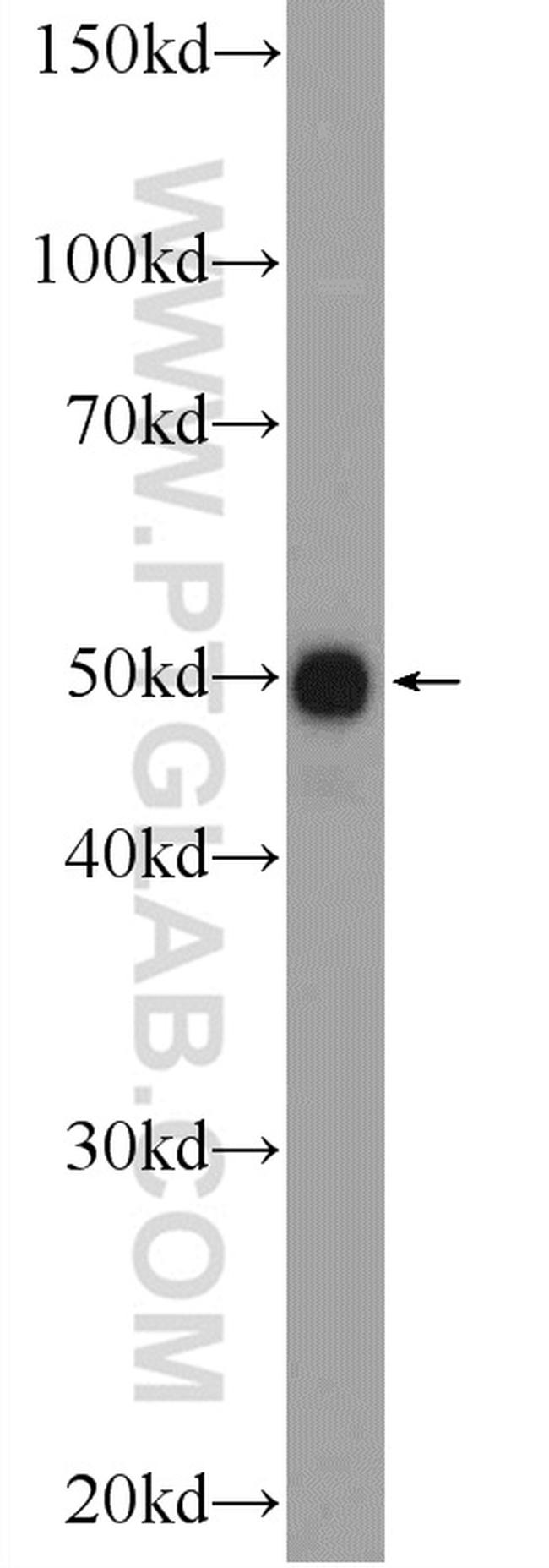 PYGO2 Antibody in Western Blot (WB)